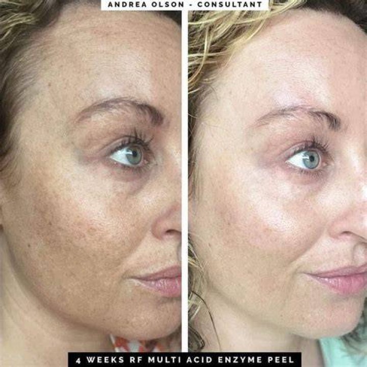 Enzyme Peel Enzyme Peel