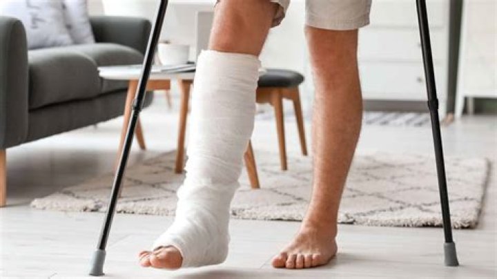 How To Fix A Broken Leg