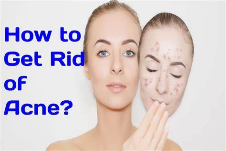 how to get rid of acne scars how to get rid of acne scars
